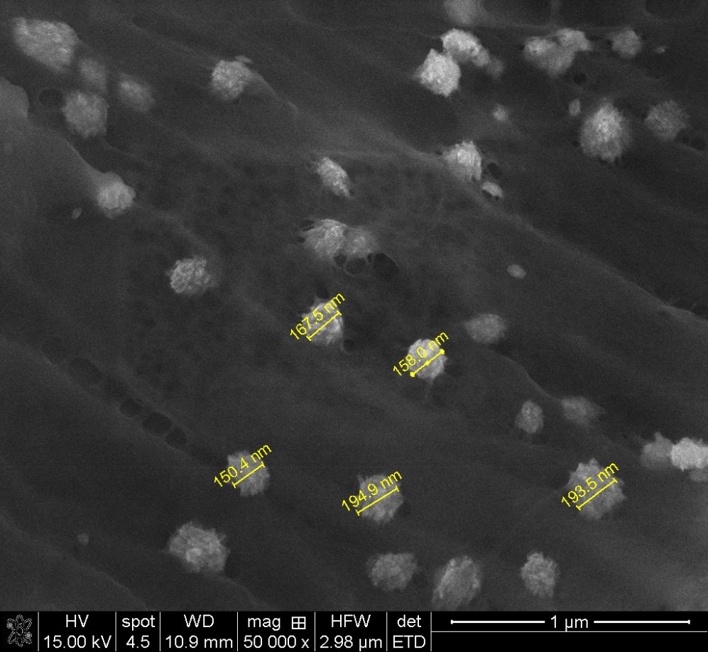 Electron microscope image showing nanoparticles